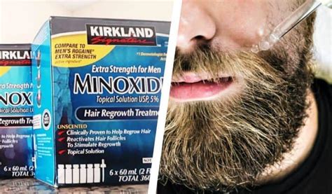 Natural coconut oil for beard growth: Minoxidil for Beard Growth: Definitive Guide