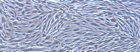 Five Tips For Scaling Up Human Mesenchymal Stem Cells Biocompare The