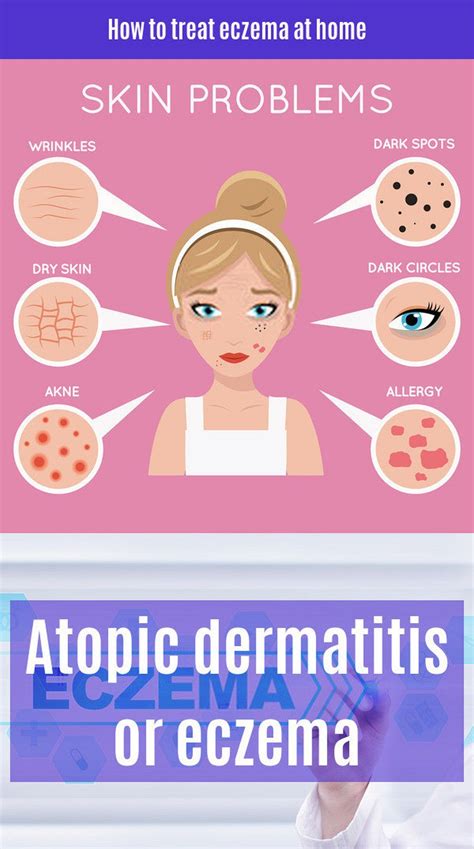 Atopic Dermatitis Or Eczema Eczema Is A Skin Condition That Primarily