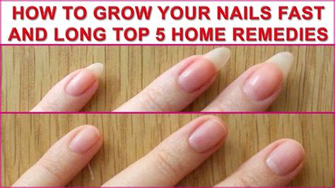 How To Grow Your Nails Fast And Long Top 5 Home Remedies Grow Nails