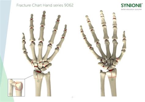 Single Bone Hand Synbone Ag Pdf Catalogs Technical Documentation