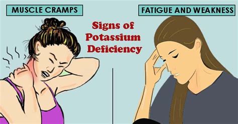 5 Signs Of Potassium Deficiency Or Hypokalemia That You Shouldnt