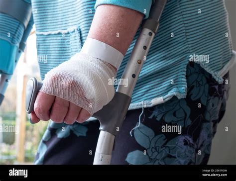 Injured Woman Trying To Walk On Crutches At Home Stock Photo Alamy