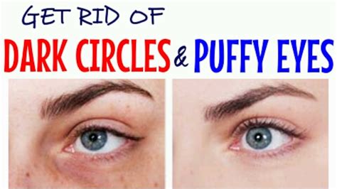 Get Rid Of Dark Circles And Puffy Eyes 5 Best Natural Remedies Cheap