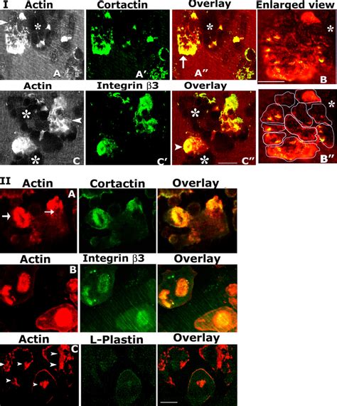 I Confocal Analysis Of Localization Of Actin With Cortactin And