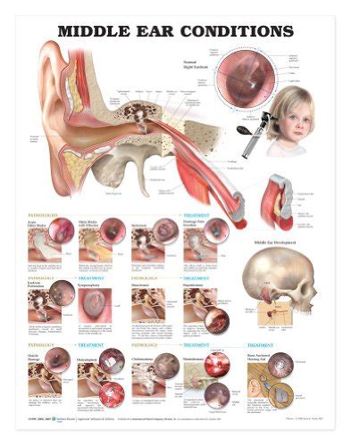 Ear Anatomy Chart Middle Ear Conditions Wantitall