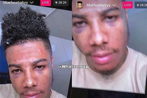 Blueface Gets 2 Black Eyes Allegedly From Chrisean Rock Whatsonrap