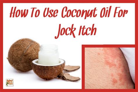 Skin conditions such as eczema, psoriasis, and seborrheic dermatitis can cause red or silver scaly rashes in a variety of areas including the groin. How To Use Coconut Oil For Jock Itch | Hybrid Rasta Mama