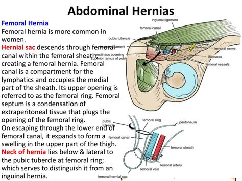 Ppt Posterior Abdominal Wall Powerpoint Presentation Free Download