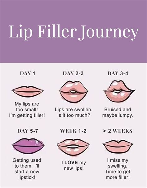 The Lip Filler Cycle We All Go Through But We Wouldnt Have It Any