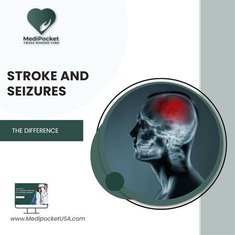 Difference Between Stroke And Seizure Medipocket Usa