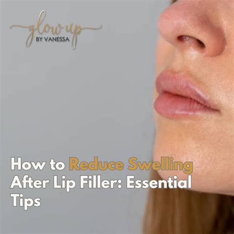 How To Reduce Swelling After Lip Filler Essential Tips Glow Up By