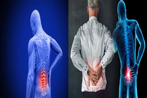 Lower Back Pain Meaning Symptoms Causes And More