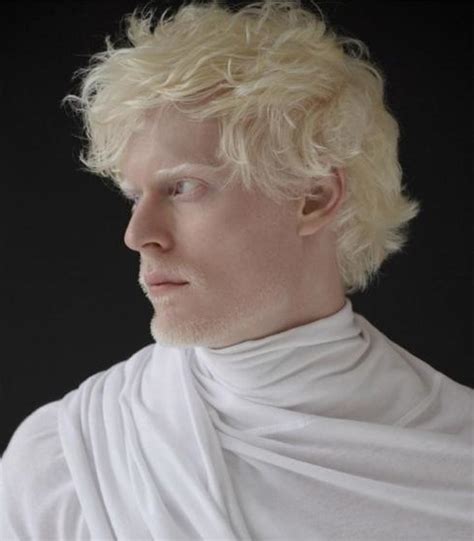 Stephen Thompson Albino Human Albino Men Albino Model