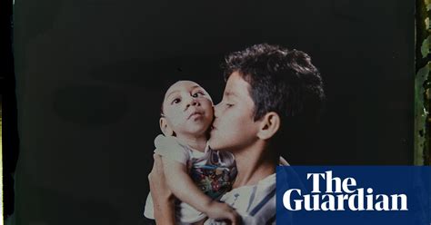 Portraits Of Families With Babies Disabled By Zika Virus Global