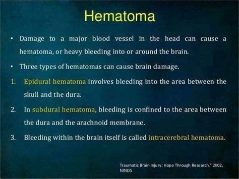 Types Of Hematoma Neet Pg Medicaltalknet The Best Medical