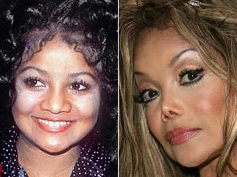 The Most Expensive Celebrity Plastic Surgeries Ever And How Much They Cost Cirug A Pl Stica