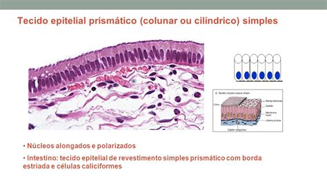 Tecidoepitelialprismáticocolunaroucilíndricosimples Patologia