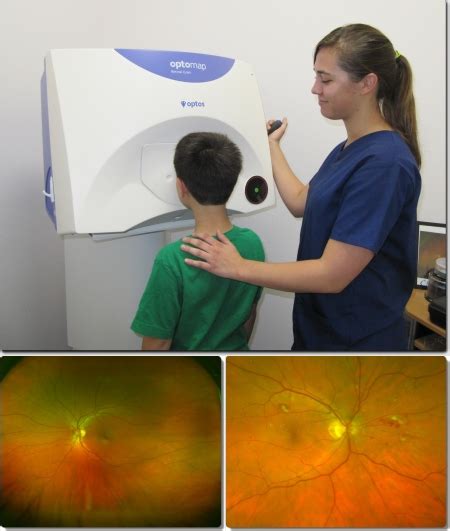 Eyecare Technology Torrance Optometry