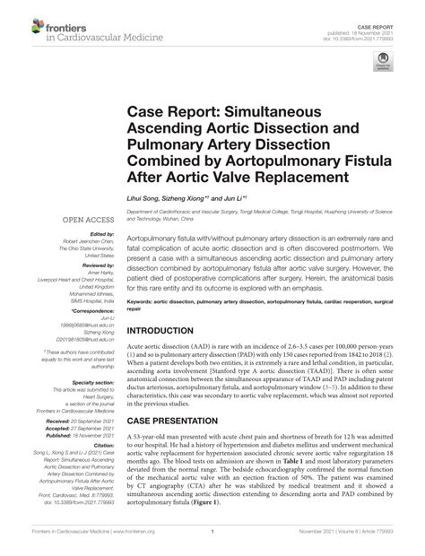 PDF Case Report Simultaneous Ascending Aortic Dissection And