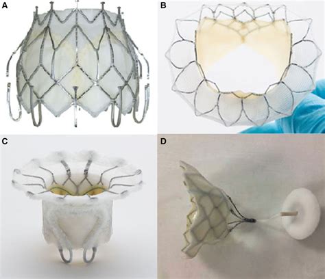 Transcatheter Structural Heart Interventions For The Treatment Of