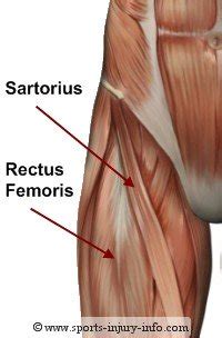 Your hip flexor muscles can be defined as a group of muscles which is sometimes referred to as the iliopsoas (inner hip muscles). Learn About Hip Anatomy - Sports Injury Info