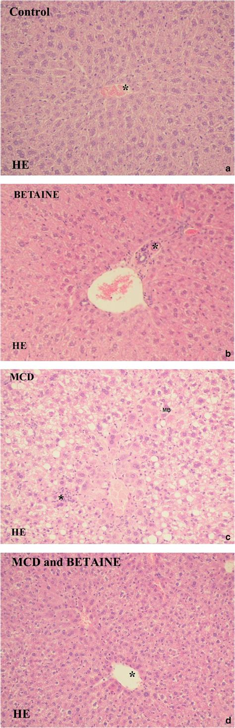 Histopathological Findings In Liver Tissue Of Mice Treated With