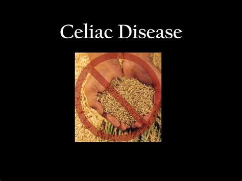 Ppt Celiac Disease Powerpoint Presentation Free Download Id1003357