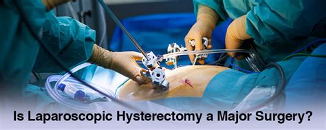 Is Laparoscopic Hysterectomy Considered As A Major Surgery Gauri