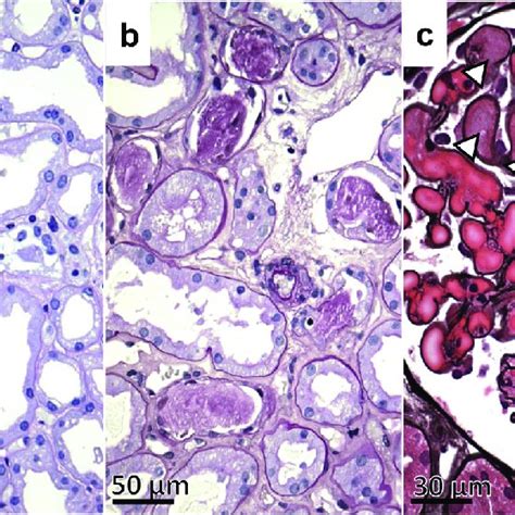 Representative Photomicrographs Of Ischemia Reperfusion Changes