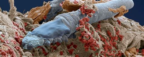 Your Skins Microbiome And The Mites On Your Face
