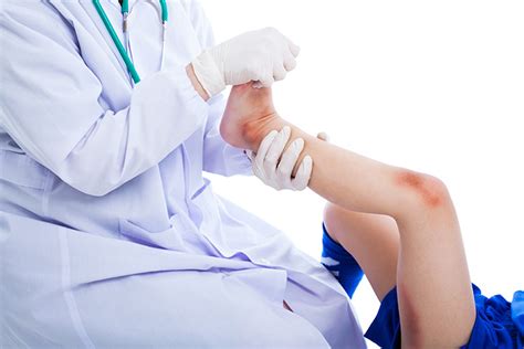 Causes Of Knee Pain In Childrentreatment And When To See A Doctor