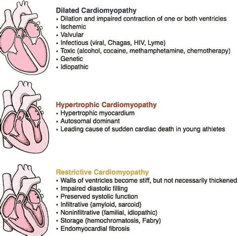 Types Of Cardiomyopathy Medizzy