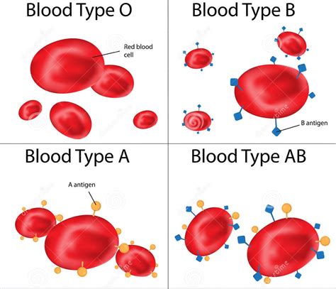 A Positive Blood Type Plorasimply