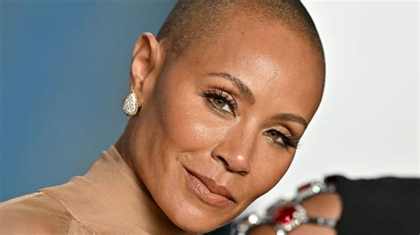 Alopecia Which Celebrities Have The Condition