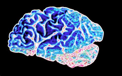 Is Friendly Fire In The Brain Provoking Alzheimers Disease