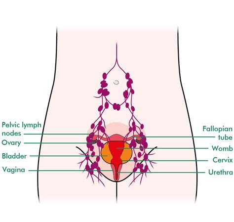 Most Cancers Cervix Lymph Nodes