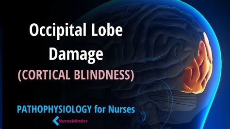 Cortical Blindness Occipital Lobe Damage Nursing Pathophysiology In A