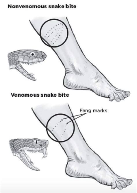 Daily Survival Tip Snake Bite Identification By Wound Pattern