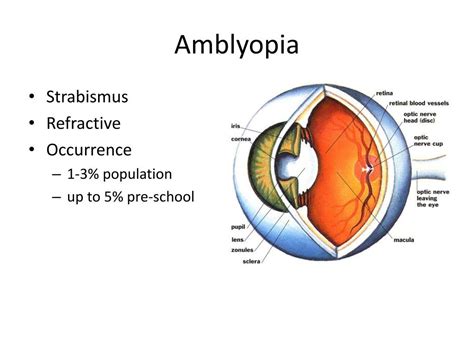 Ppt Paediatric Ophthalmology Community To The Hospital Powerpoint