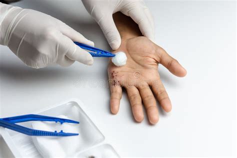 A Nurse Cleaning Patient Wound Stock Photo Image Of Healthy Therapy