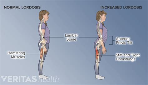 Understanding Lower Back Anatomy Spine Health