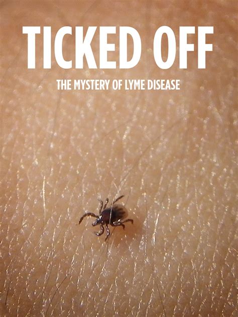Watch Ticked Off The Mystery Of Lyme Disease Prime Video