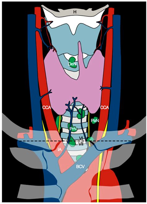 Cancers Free Full Text Central Compartment Neck Dissection In