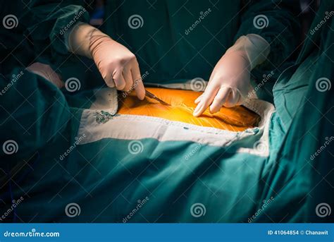 Incision Stock Photo Image Of Chest Patient Incision 41064854