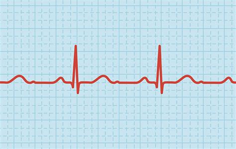How To Lower Your Heart Rate New Health Advisor
