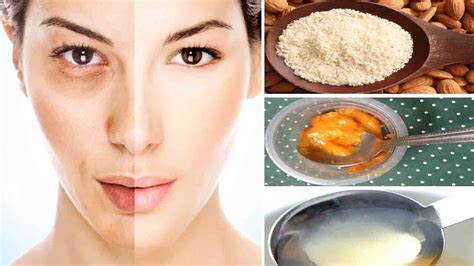 Melasma Cure Home Remedies Hyperpigmentation Treatment At Home