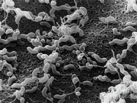 Campylobacter Jejuni Bacteria Photograph By Moredun Animal Health Ltd