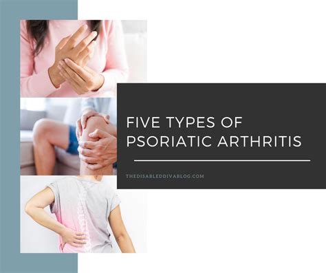 Five Types Of Psoriatic Arthritis The Disabled Diva Blog