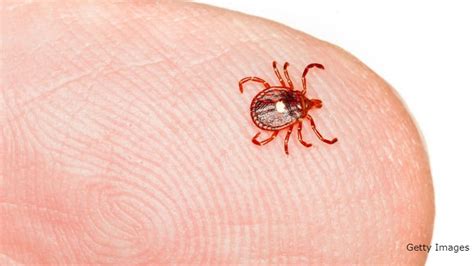 Delayed Reaction Man Bitten By Tick Is Now Allergic To Meat